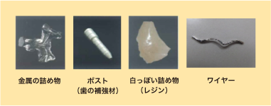 金属の詰め物/ポスト(歯の補強材)/白っぽい詰め物(レジン)/ワイヤー
